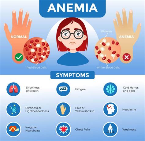 Anemia .